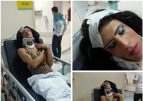 Haber | İstanbul`da iki trans kadın daha nefret saldırısına uğradı 